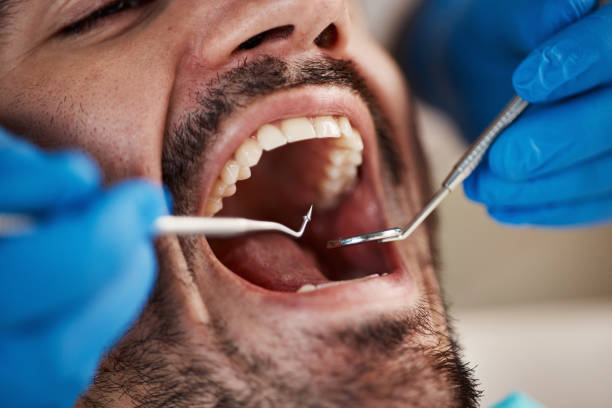 Best Emergency Dentist for Knocked-Out Tooth in Mount Union, PA